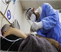 سوريا.. الكشف عن أسباب ازدياد حالات مرض الفطر الأسود بالبلاد