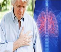 «دراسة»: التدخين السبب الأكثر شيوعا في سرطان الرئة