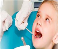 الأسنان الطباشيرية.. يعاني منها الأطفال وتحير الأطباء
