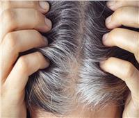 يسبب «أزمة نفسية للسيدات».. شيب الشعر المبكر وكيفية علاجه 