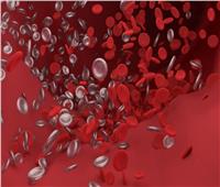 دراسة: فصيلة الدم تؤثر على خطر الإصابة بفيروس كورونا