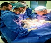 استخراج محمول من معدة مريض في جراحة نادرة بمستشفى كفرالزيات العام بالغربية 