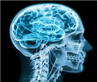 5 حقائق «أساطير» عن إصابات الدماغ