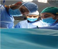 فريق طبي بوحدة تشوهات عظام قنا العام ينجح في إنقاذ قدم فتاة من البتر
