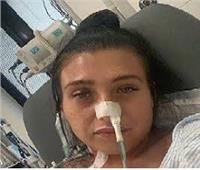بعد عملية تجميل.. فتاة أسترالية تصاب بعدوى خطيرة نادرة