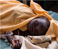 جنوب السودان يسجل أولى الإصابات بالكوليرا منذ 2017.. ووفاة شخص