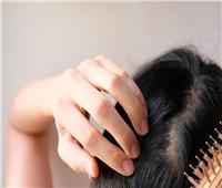 أبرزها الضغط العصبي.. 6 أسباب رئيسية لتساقط الشعر 