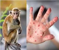 الصحة العالمية تحذر من خطر انتشار «جدري القرود» في الأشهر المقبلة بأوروبا