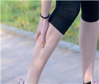 علامات في الساقين تشير إلى ارتفاع مستوى الكوليسترول في الدم