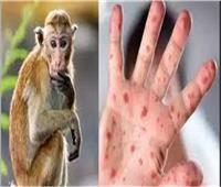 هل هناك إصابات بجدري القرود في حديقة الحيوان؟ | فيديو
