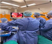 نجاح جراحة «ويبل» بالمنظار الجراحي لمريض بمركز علاج الأورام بدمنهور