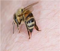 تنهي حياة 50 شخصا سنويًا.. كل ما تريد معرفته عن حساسية لسعات النحل والدبابير