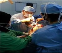 إجراء ١٠ عمليات بمستشفى رشيد ضمن مبادرة رئيس الجمهورية للقضاء على قوائم الانتظار 