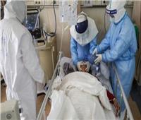 بعد رصد حالة في الصين.. تعرف على «الكوليرا» وسلالاتها