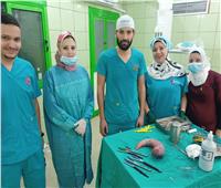 نجاح الفريق الطبي بمستشفى كفر الدوار في إجراء أول عملية جراحة تكميم للمعدة