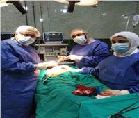 إجراء 37 عملية جراحية متنوعة بمستشفى الدلنجات المركزي بالبحيرة