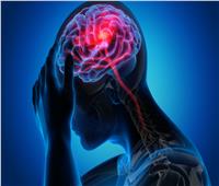 4 أعراض تنذر بخطر الاصابة بالسكتة الدماغية لدى النساء