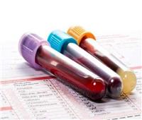 اختبار دم جديد يقلل من وفيات مرضى السرطان