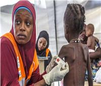 يونيسف: مصرع 700 طفل في مراكز تغذية بالصومال