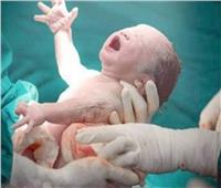 استشاري: تفضيل الولادة القيصرية على الطبيعية سببه انتشار المفاهيم الخاطئة