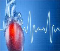 دراسة : عدم انتظام ضربات القلب لدى المراهقين قد يكون ناجما عن تلوث الهواء