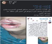 إصابة طالب بـ «عاهة مستديمة» في مدرسة «حدائق المعادي التجريبية» |خاص