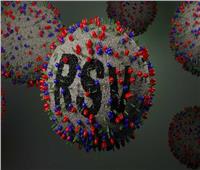 تاج الدين: «الفيروس المخلوي» ينتقل بالكحة وضرورة عزل المصاب| فيديو
