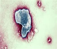 استشاري: «الفيروس المخلوي» غير مقلق والاستهتار به يؤدي لمضاعفات| فيديو