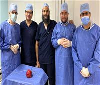 استخراج فوطة جراحية مهملة منذ 7 أعوام من بطن مريض بمستشفى جامعة المنوفية 