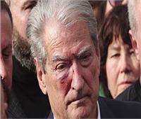 إصابة زعيم المعارضة الألبانية في رأسه خلال احتجاجات مناهضة للحكومة