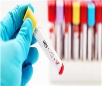 «الصحة العالمية» تكشف أسباب العدوى بفيروس نقص المناعة «الإيدز»