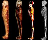بـ«الأشعة المقطعية».. كشف أسرار مومياء «الصبي الذهبي» بالمتحف المصري |صور