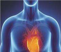 عميد معهد القلب الأسبق: المريض الخاضع لتركيب دعامة يمكنه الصيام بشكل طبيعي