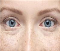 احذر.. لون عينك قد يكون إشارة لإصابتك بهذا المرض