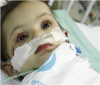 الصحة: تفعيل منظومة العلاج الوقائي للأطفال "مرضى الهيموفيليا" بمستشفيات التأمين الصحي