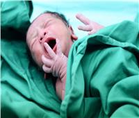 ظاهرة طبية نادرة.. ولادة طفل في الهند مع ذراع ثالثة في ظهره| فيديو