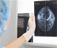 كيف يمكن أن يساعد الذكاء الاصطناعي الأطباء في اكتشاف سرطان الثدي ؟