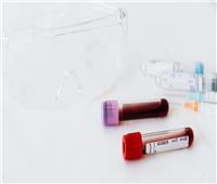 دراسة بريطانية: تحليل دم جديد يمكنه تحديد 50 نوعًا من السرطان