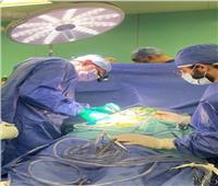 قسم القلب بمستشفى جامعة أسوان يجري عملية قلب مفتوح لسيدة
