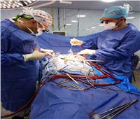 إجراء جراحتي قلب مفتوح لسيدتين بمستشفى الزقازيق العام