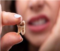 دراسة حديثة تكتشف معدن داخل الإنسان قد يكون بديلا للفلورايد في محاربة تسوس الأسنان