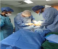 إجراء 9 عمليات مجانية ضمن «100 يوم صحة» بمستشفى ديروط في أسيوط 