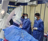 إجراء جراحات القلب المفتوح المتقدمة بمستشفى الزقازيق العام  