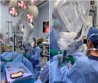 نجاح فريق طبي سعودي في إجراء عمليتين لطفلة في وقت واحد 