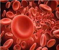 استشاري أمراض الدم: الأنيميا عَرَض وليس مرض.. و900 مليون إنسان يعانون «نقص الحديد»