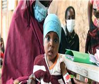 الأمم المتحدة: أكثر من 2.1 مليون شخص يعانون من انعدام الأمن الغذائي الحاد في تشاد