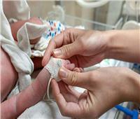 في يومها العالمي.. أعراض الولادة المبكرة أسبابها وكيفية الوقاية منها؟