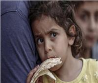 يونيسف: 335 ألف طفل في غزة معرضون بشدة لخطر سوء التغذية الحاد والوفاة