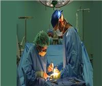 إجراء 65 ألف عملية جراحية ضمن مبادرة القضاء على قوائم الانتظار بالمنيا