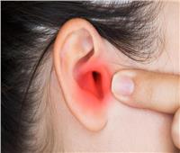 لصحتك.. أعراض الإصابة بالتهاب الأذن الوسطى ونصائح للوقاية